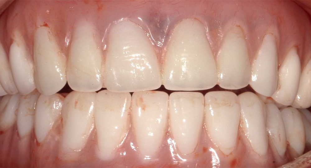 Smile Gallery Dental Nook