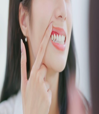 Close up of a patient pointing to inflamed gums showing signs of gum disease at Dental Nook. Early treatment helps protect teeth and maintain healthy gums.